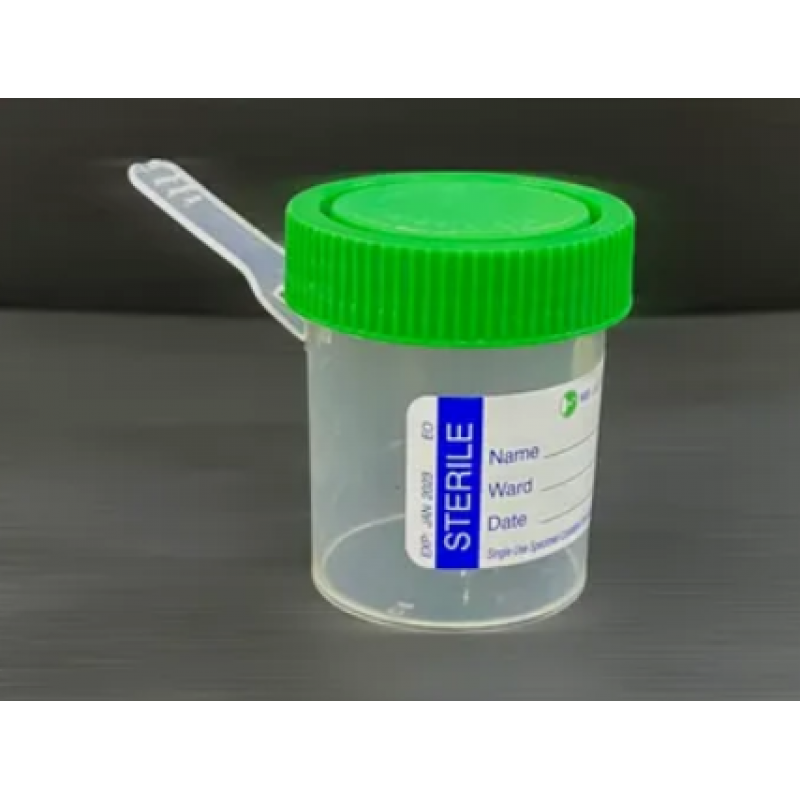 Buy Stool Container 50mL get price for lab equipment